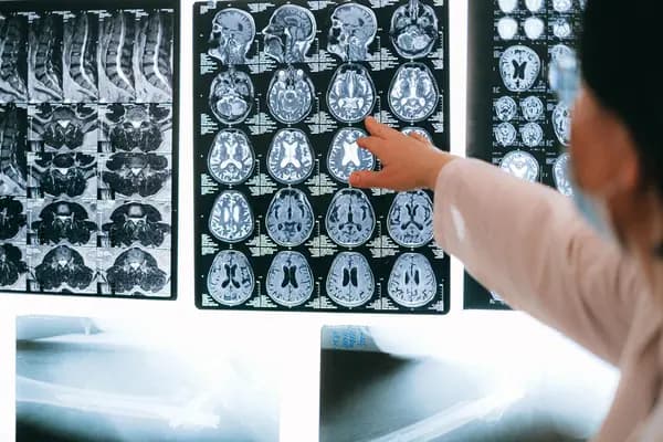 Groundbreaking Brain Treatment